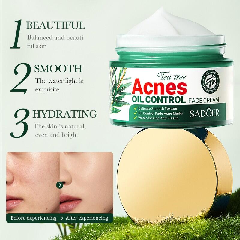 Crema Facial Control del Acné SADOER 50ml – Piel Limpia y Saludable